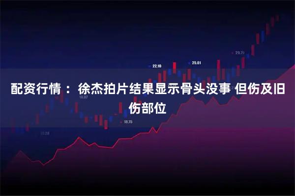 配资行情 ：徐杰拍片结果显示骨头没事 但伤及旧伤部位